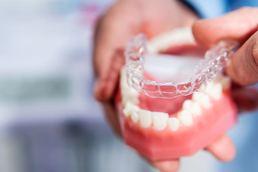 How Old Do I Need to Be to Get Invisalign?