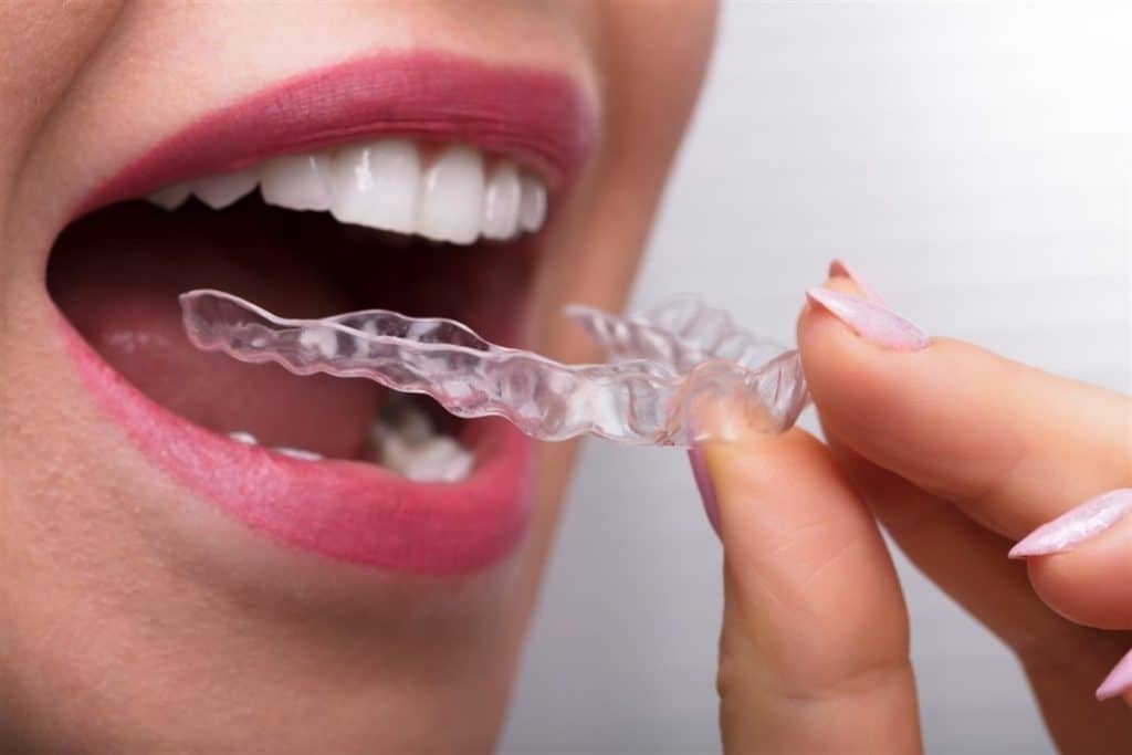 Can you eat with Invisalign?