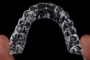 Nighttime-Only Invisalign: Pros, Cons, and Must-Know Facts