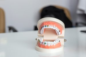 Braces Guide: Essential Tips for a Successful Orthodontic Journey