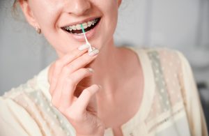 Braces Guide: Essential Tips for a Successful Orthodontic Journey