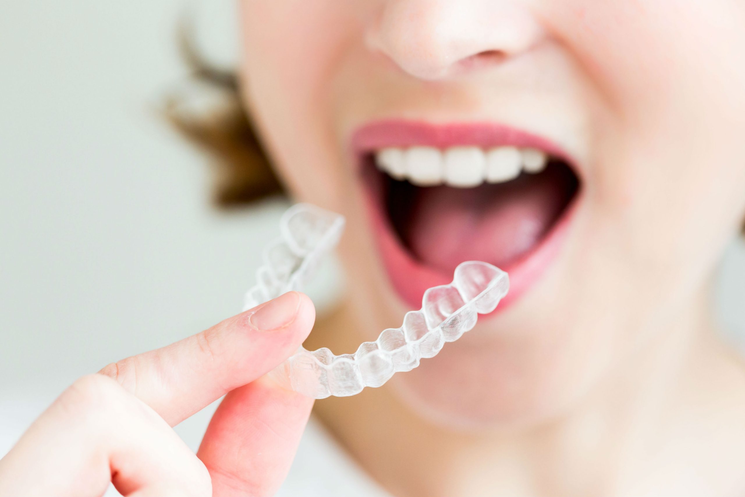 Invisalign Treatment Time: What to Know for Faster Results