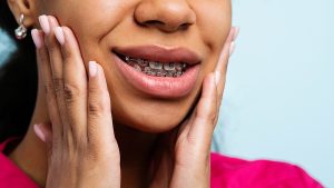 Foods to Avoid Wearing Braces: Expert Advice for Better Results