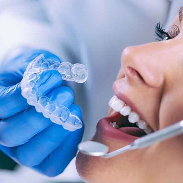 Orthodontist preparing Invisalign for placement