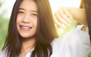 Maintaining braces while attending college