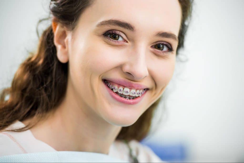 patient smiling with braces near Buckley WA