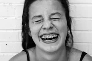 Braces School Hacks: Essential Tips for a Smooth Experience